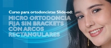 Curso para ortodoncistas Slide-od: Micro ortodoncia fija sin brackets con arcos rectangulares