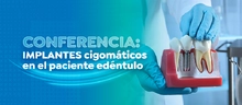 Conferencia: Implantes cigomáticos en el paciente edéntulo