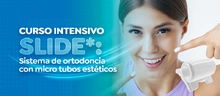 Curso Intensivo SLIDE*: Sistema de ortodoncia con micro tubos estéticos