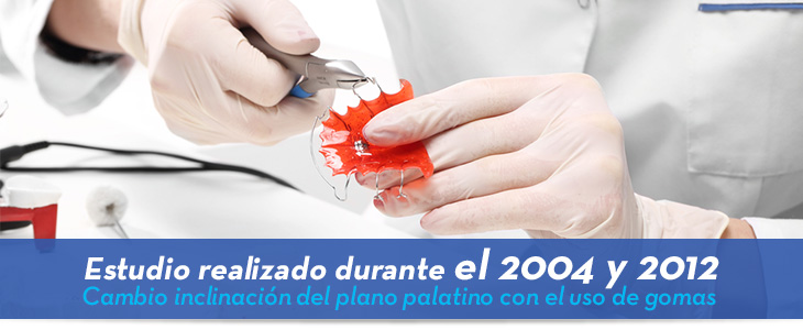Estudio realizado durante el 2004 y 2012 Cambio inclinación del plano palatino con el uso de gomas