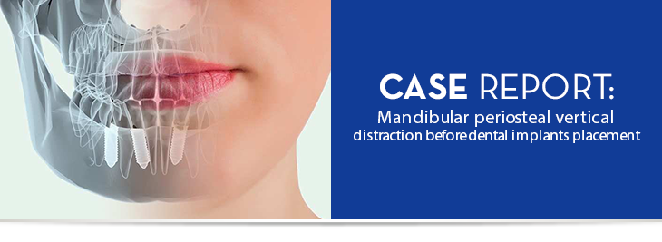 Case report: Mandibular periosteal vertical distraction before dental implants placement