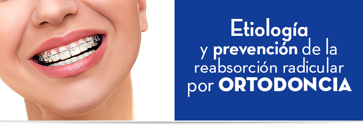 Etiología y prevención de la reabsorción radicular por ortodoncia