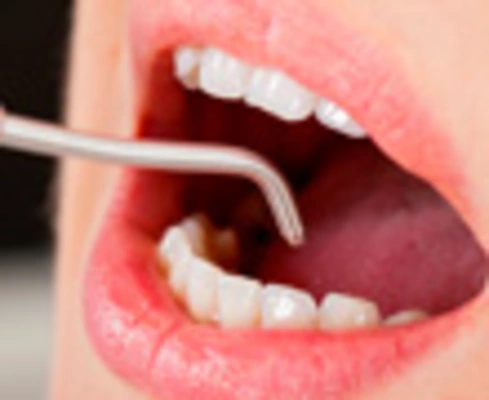 Avances tecnológicos: Israelíes reemplazan el bisturí en la ortodoncia por materiales biológicos